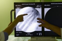 В Гатчинской больнице появится цифровой рентген